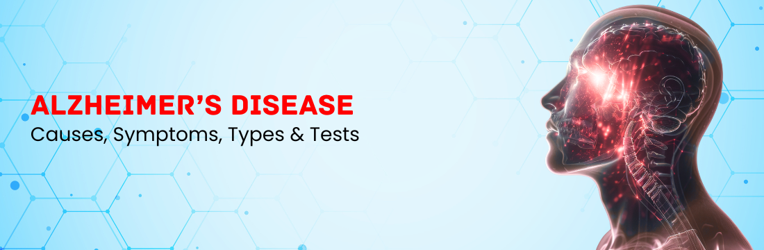 Alzheimer’s Disease: Causes, Symptoms, Types & Tests